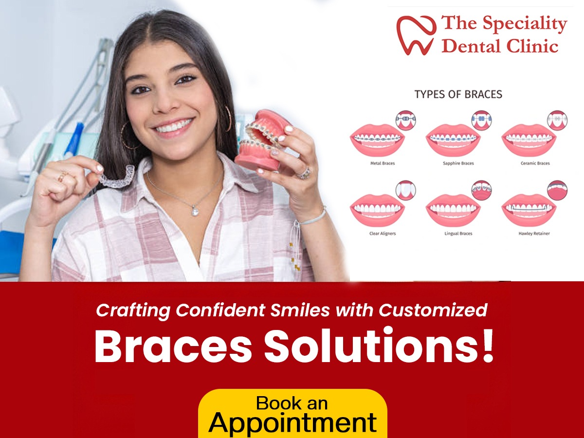 Braces