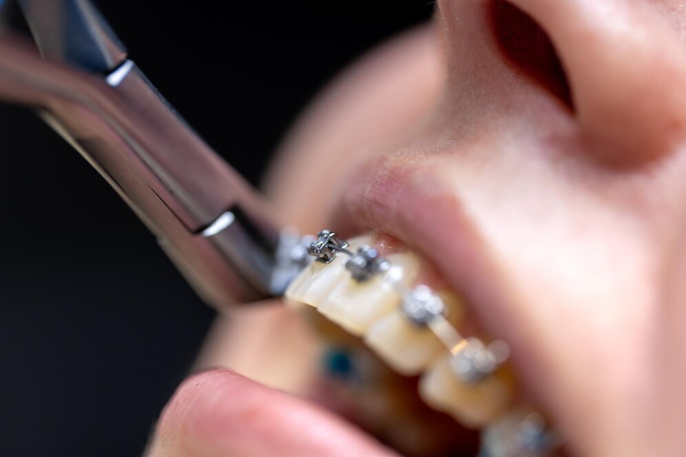 Tooth Jewellery1